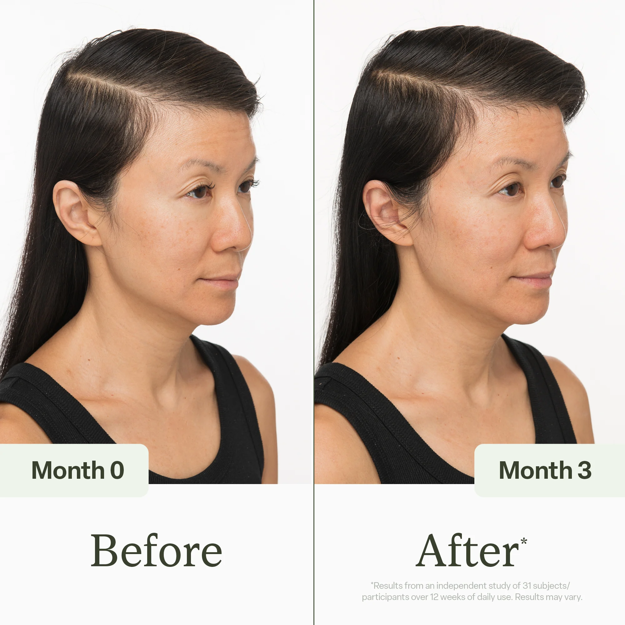 100ml Scalp Serum - Image 4