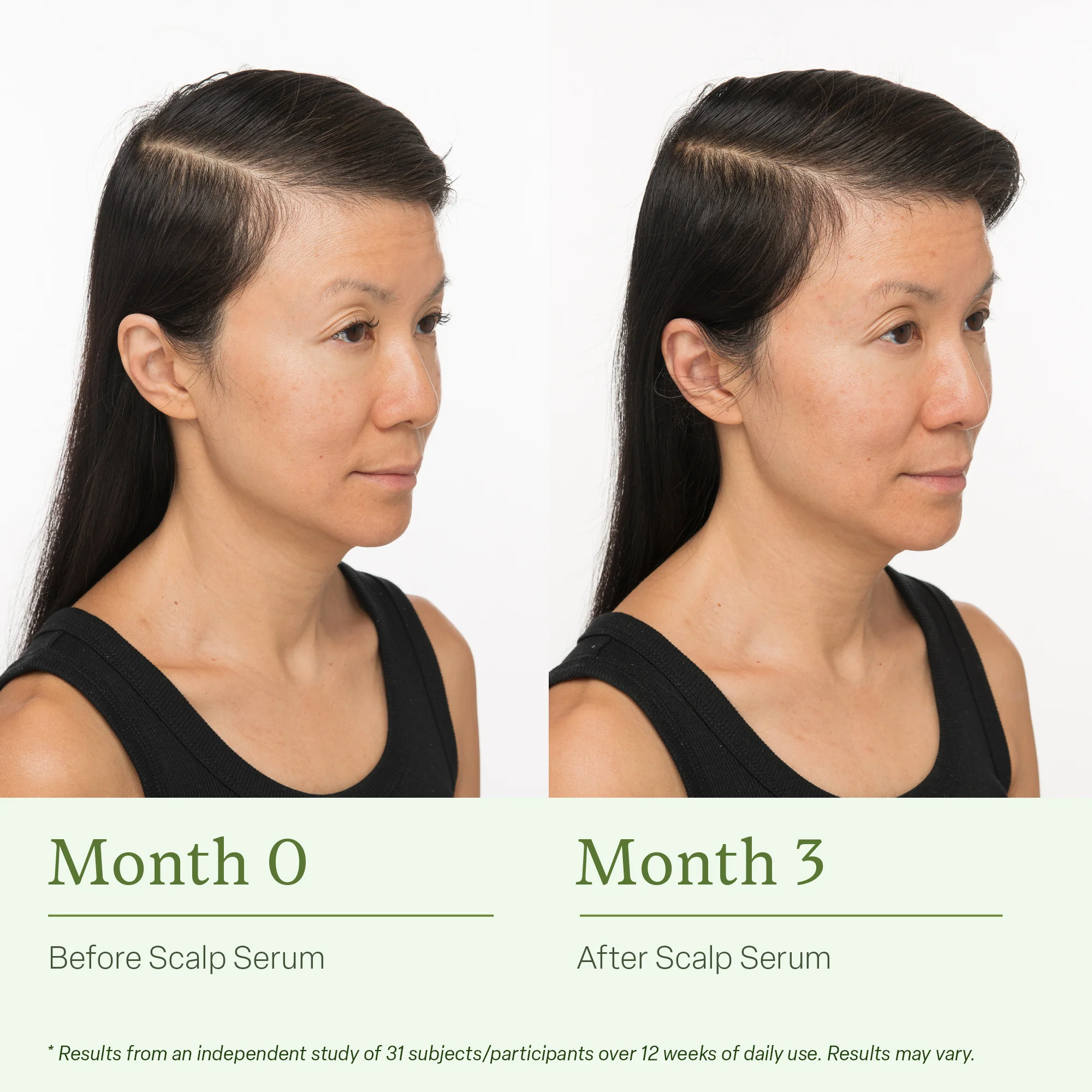 Hydrating Essentials Hair Bundle - Image 4