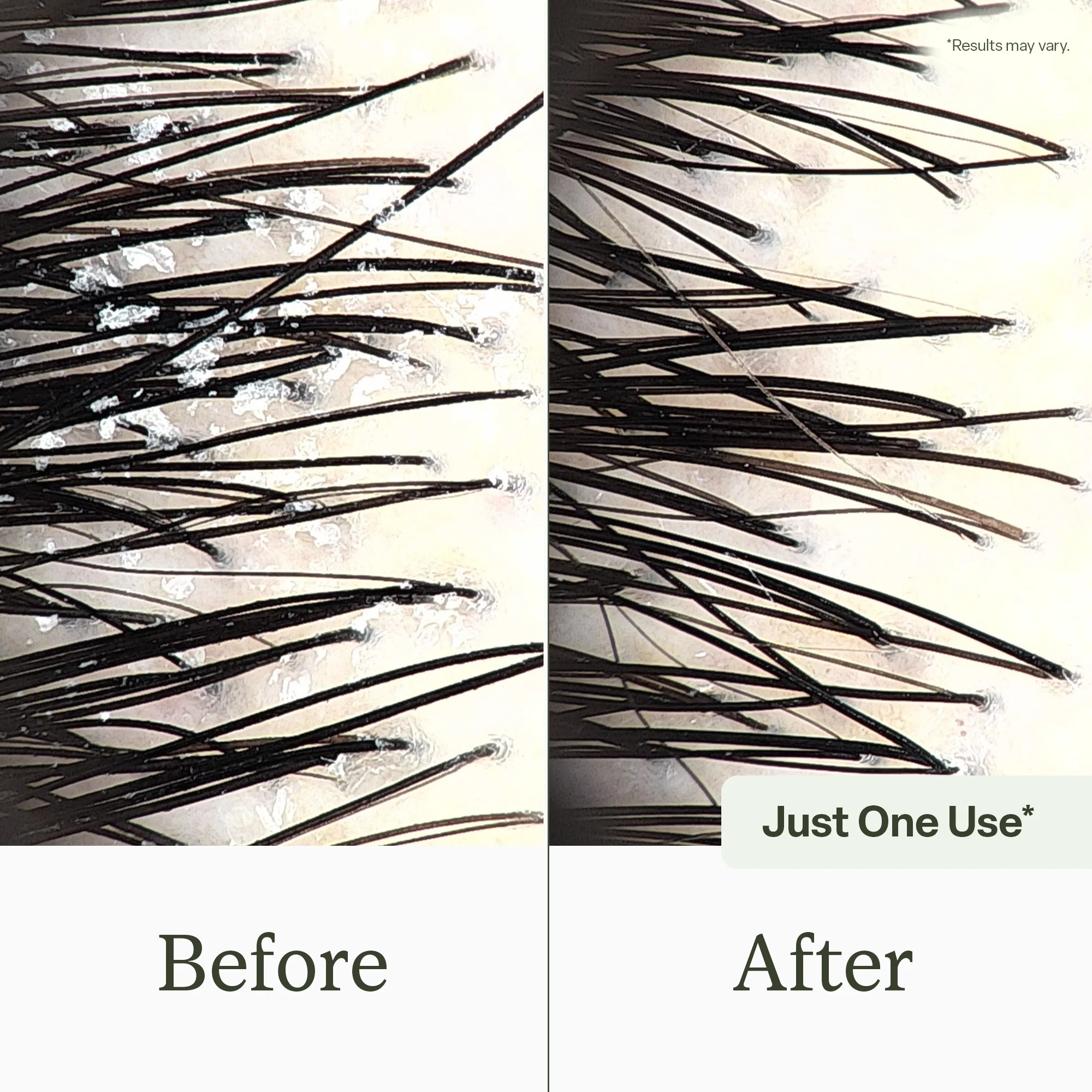 Scalp Reset Shampoo - Image 3